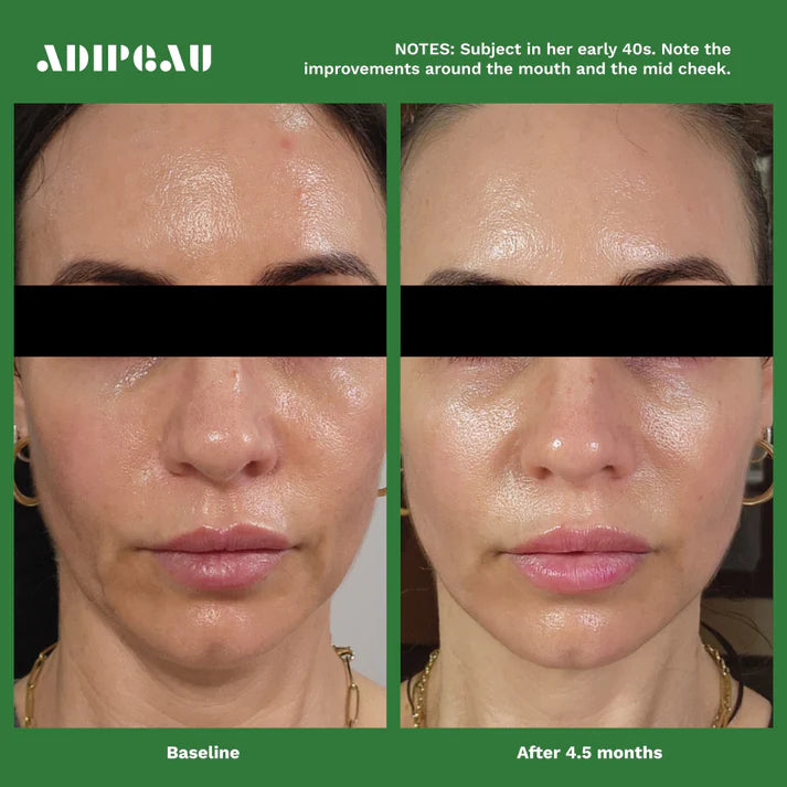 Volume Cream